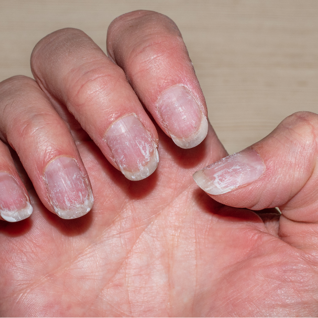 Pokata Articles (35)