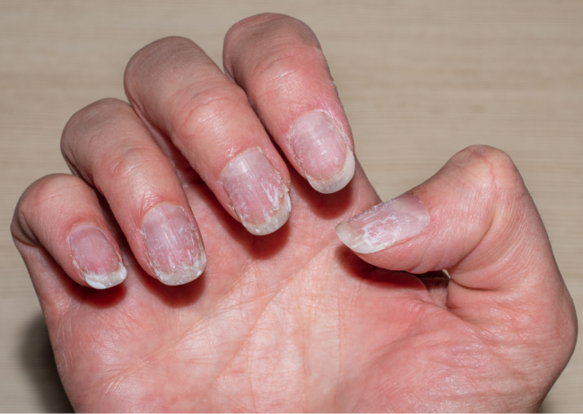 Pokata Articles (35)