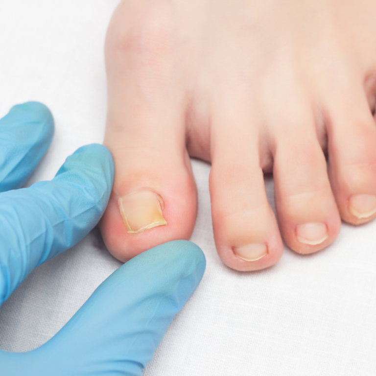 Pokata Articles (37)